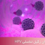 درمان زگیل تناسلی hpv در شهریار - دکتر زگیل تناسلی شهریار - دکتر اکرم قرامحمدی