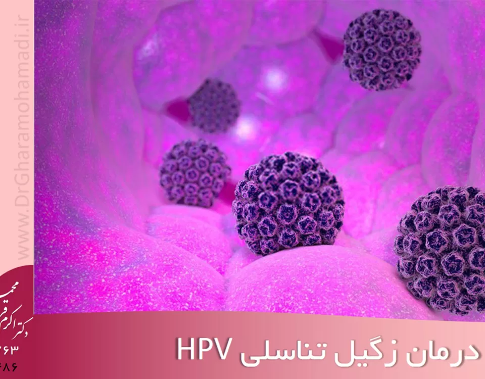 درمان زگیل تناسلی hpv در شهریار - دکتر زگیل تناسلی شهریار - دکتر اکرم قرامحمدی