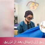 ماندگاری تزریق ژل ژنیتال بعد از تزریق - دکتر اکرم قرامحمدی دکتر زیبایی زنان شهریار