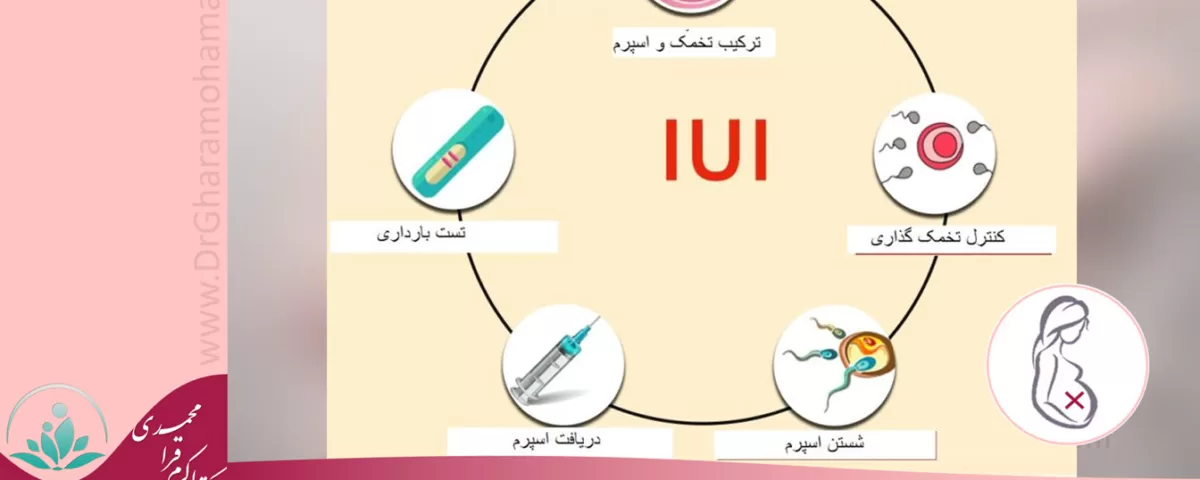 درمان ناباروری با iui - درمان ناباروری شهریار