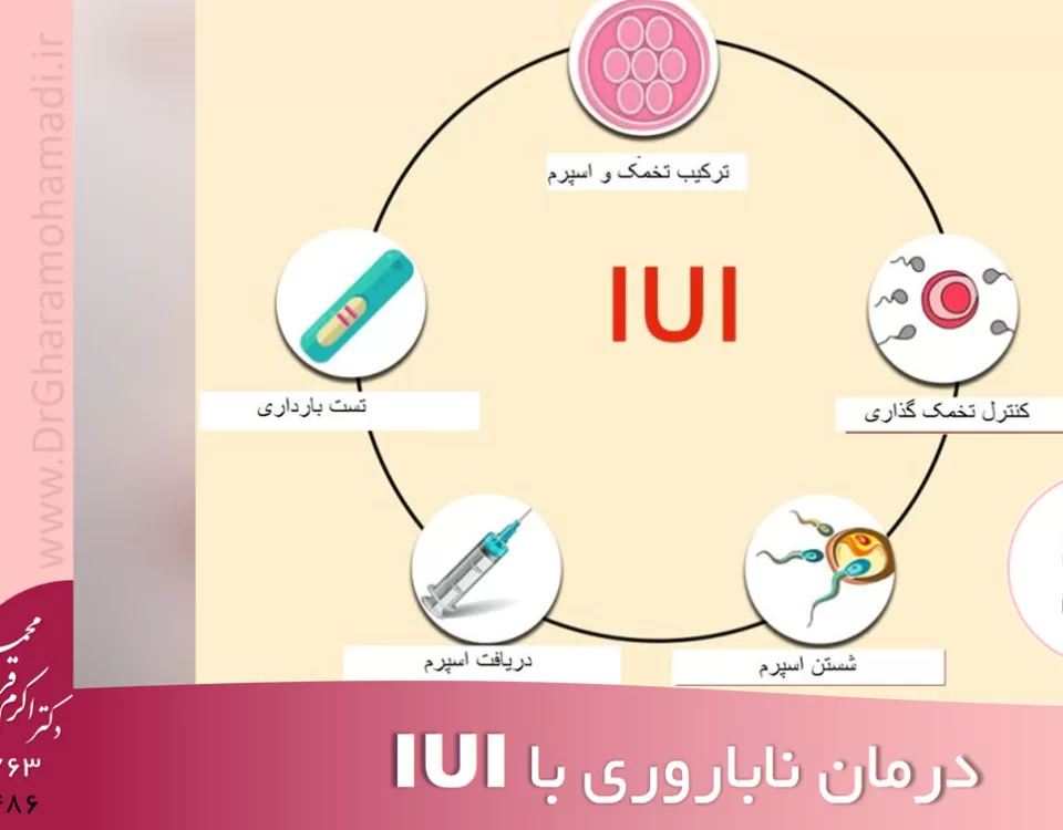 درمان ناباروری با iui - درمان ناباروری شهریار