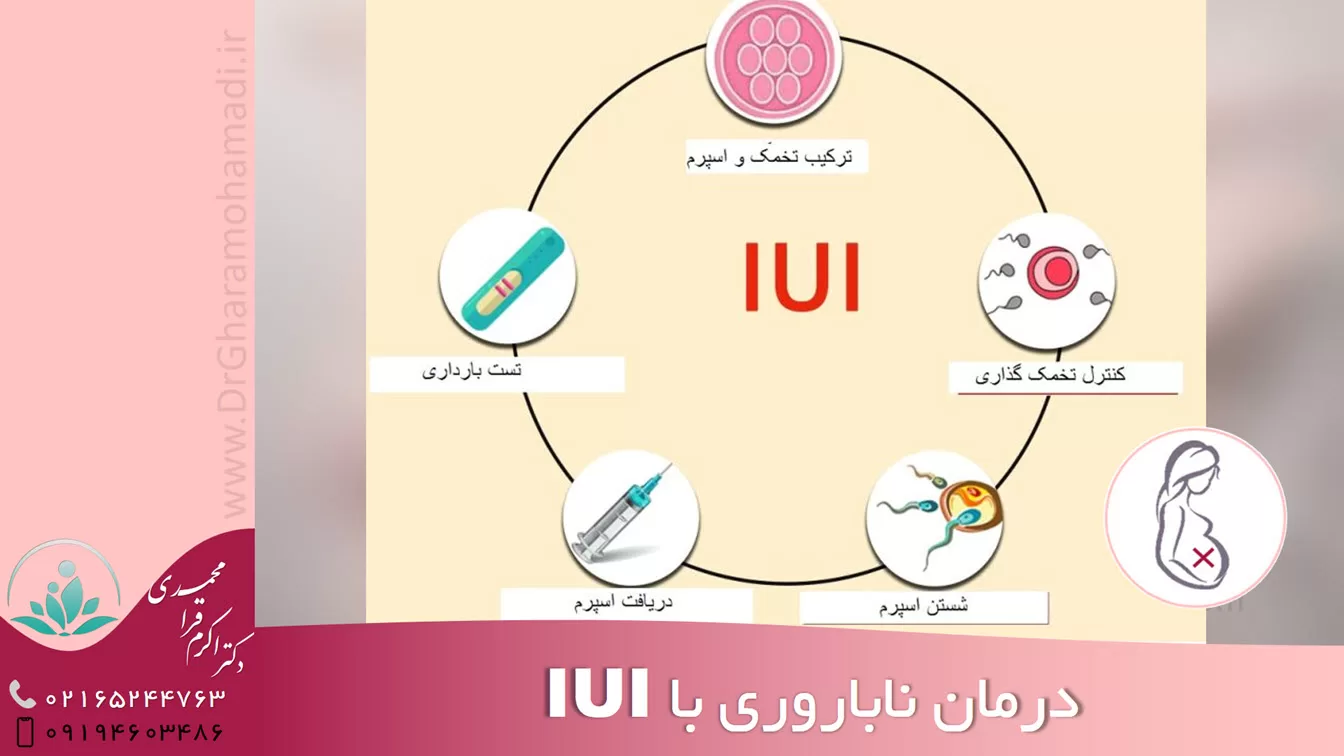 درمان ناباروری با iui - درمان ناباروری شهریار