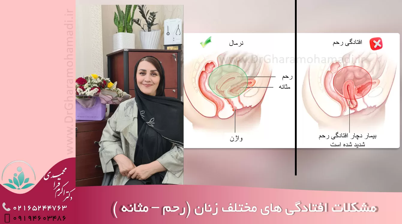 مشکلات افتادگی زنان - درمان افتادگی زنان - افتادگی رحم و مثانه در شهریار و اندیشه