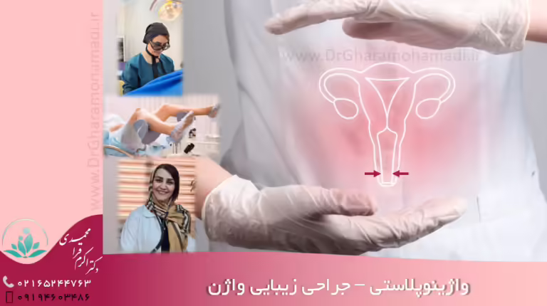 واژینوپلاستی در شهریار جراحی زیبایی واژن در شهریار