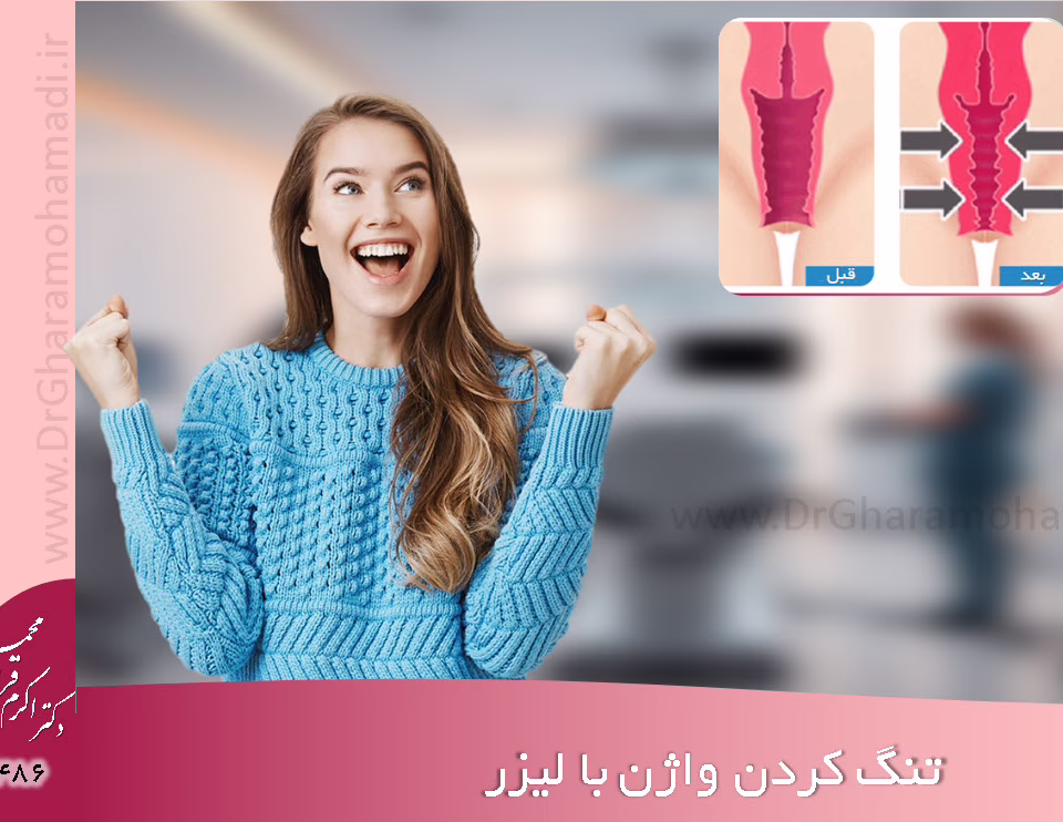 تنگ کردن واژن در شهریار اندیشه فردیس غرب تهران