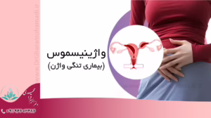 واژینیسموس بیماری تنگی واژن