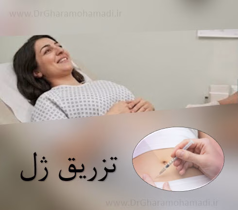 درمان خشکی و آتروفی واژن با روش های جدید 5 درمان خشکی و آتروفی واژن - تزریق ژل